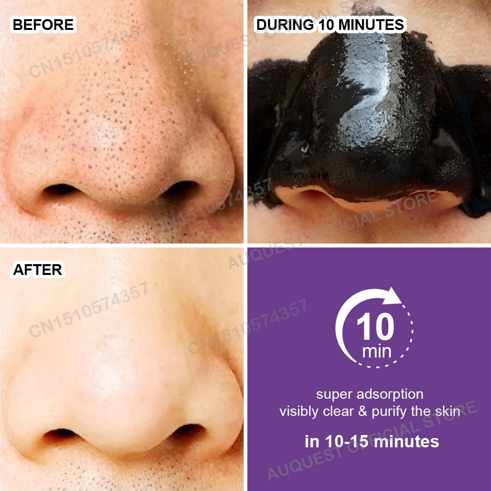 Blackhead Remover Face Mask Cream Oil-Control Nose Black Dots Mask Deep Cleansing