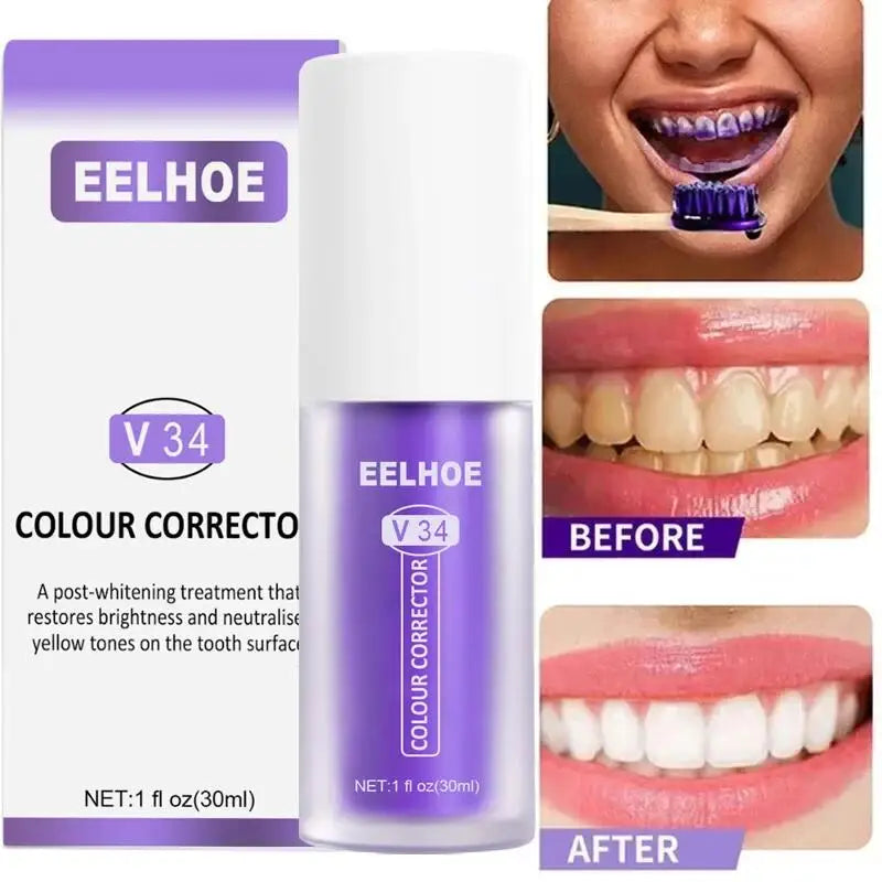 Teeth Whitening Toothpaste Remove