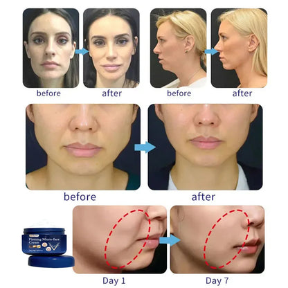 V-Shape Firming Face-lift Slimming Cream