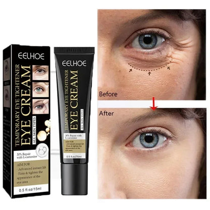 Tighten Wrinkles Eye Cream Remove