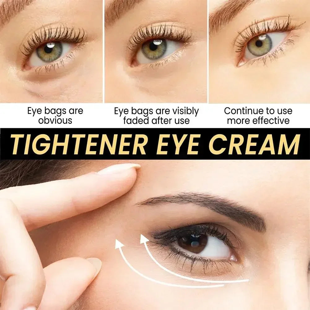 Tighten Wrinkles Eye Cream Remove