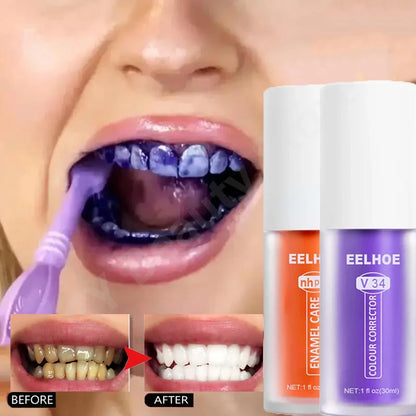 Teeth Whitening Toothpaste Remove