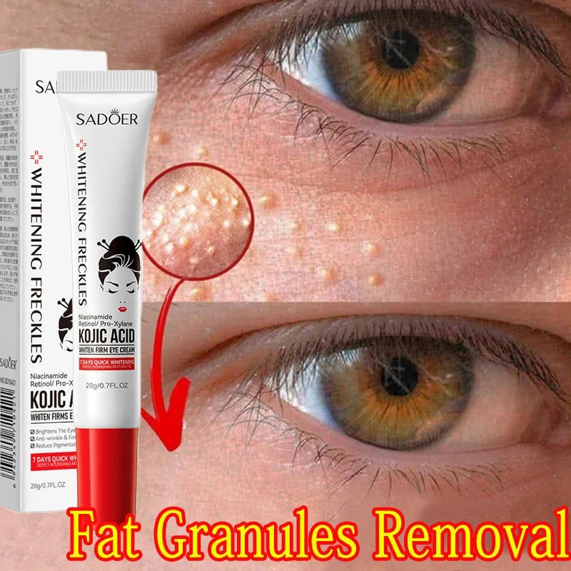 Fat Granules Remover Eye Cream