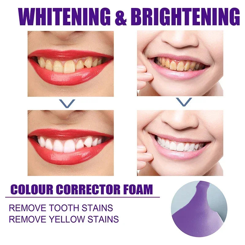 Teeth Whitening Toothpaste Remove