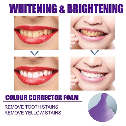 Teeth Whitening Toothpaste Remove