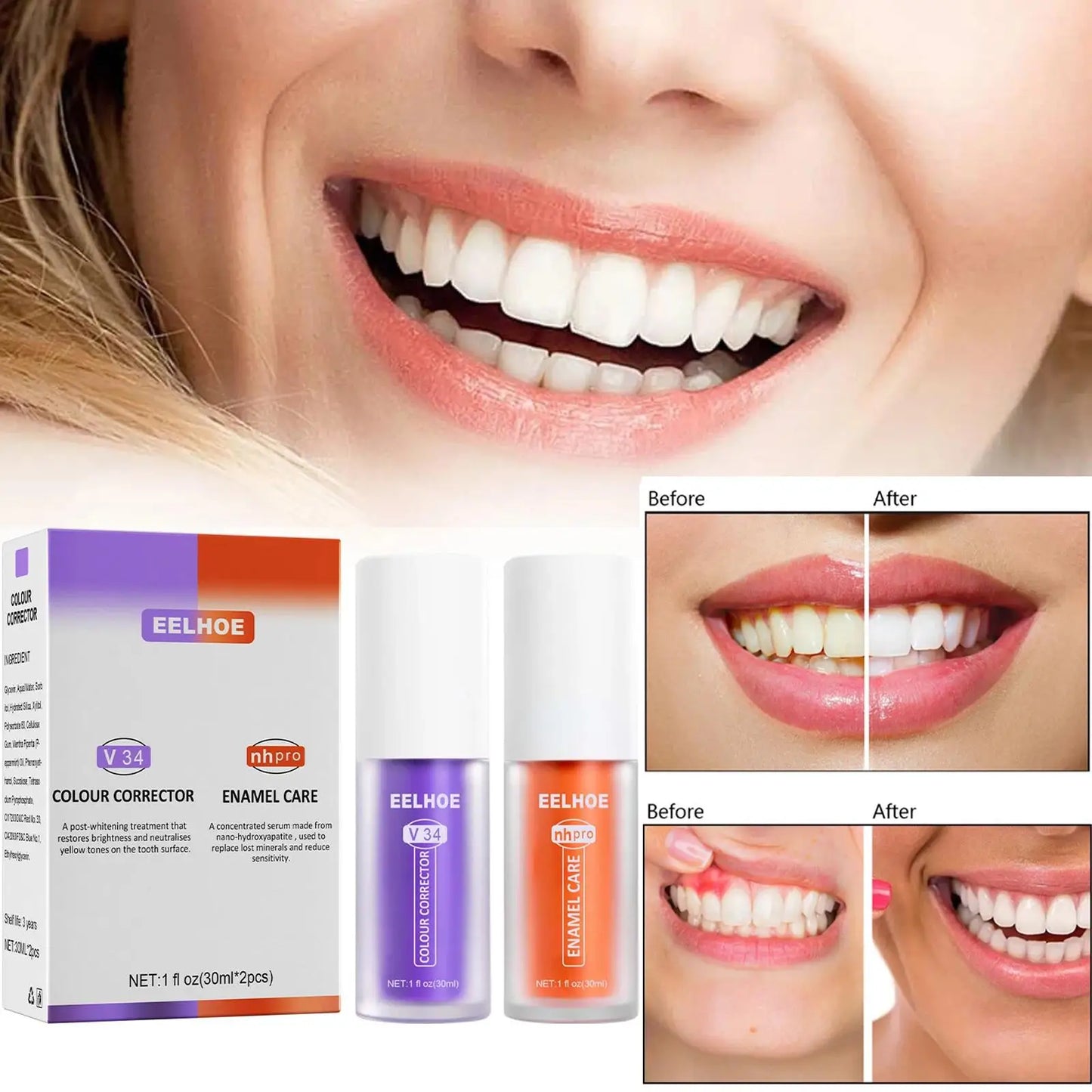 Teeth Whitening Toothpaste Remove