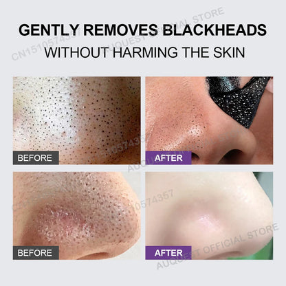 Blackhead Remover Face Mask Cream Oil-Control Nose Black Dots Mask Deep Cleansing