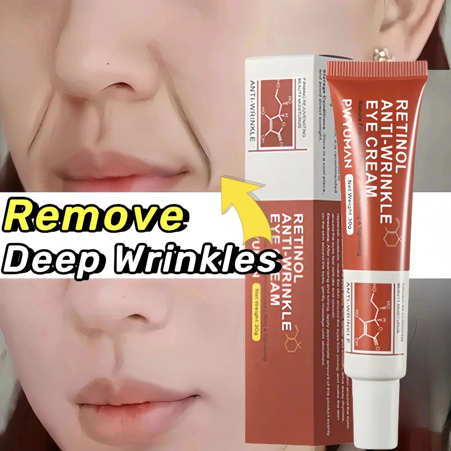 Retinol Wrinkle Removal Cream