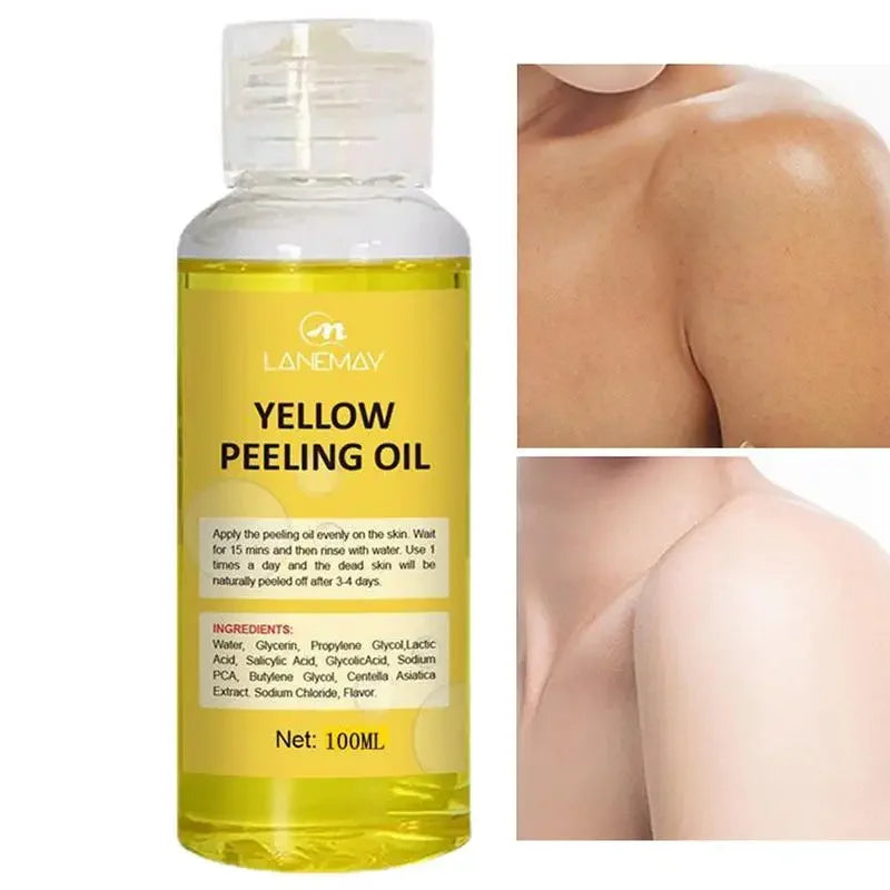 Yellow Peeling Oil Strong Yellow Peeling Oil Lighten