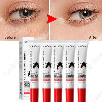 Fat Granules Remover Eye Cream